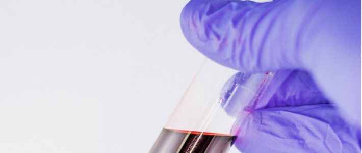 Nahaufnahme eines Reagenzglases mit roter Flüssigkeit, gehalten von einer behandschuhten Hand – Ankündigungsgrafik zum Motto "Lust auf Experimente".
