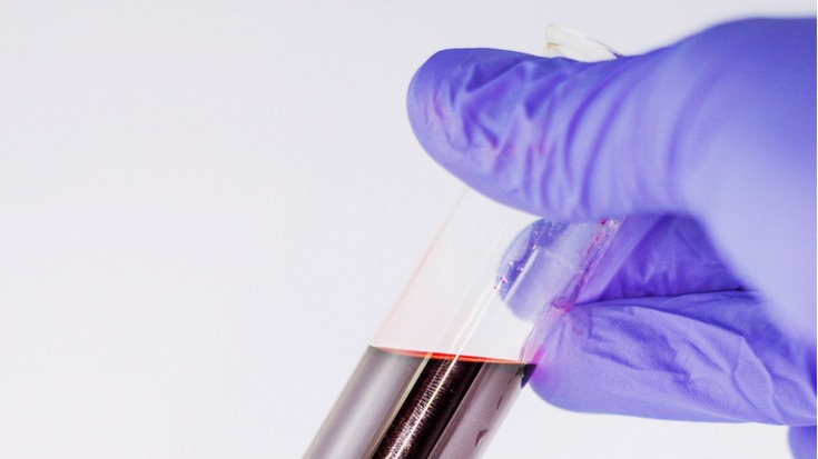 Nahaufnahme eines Reagenzglases mit roter Flüssigkeit, gehalten von einer behandschuhten Hand – Ankündigungsgrafik zum Motto "Lust auf Experimente".